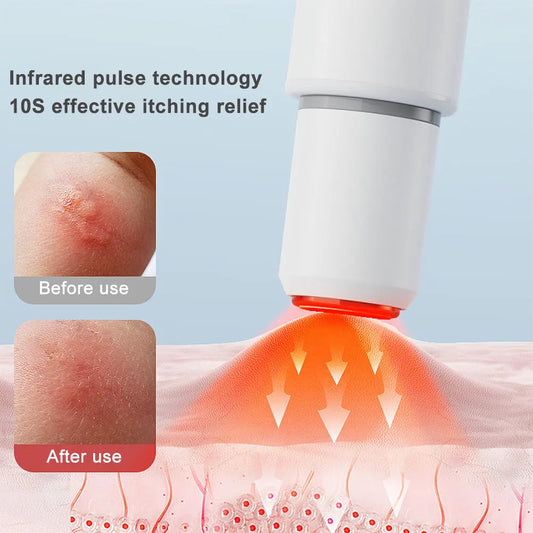 Electronic Mosquito Bite Pen Anti-Itch Pen for Adult/Kids (for Apple Plug 2pcs)